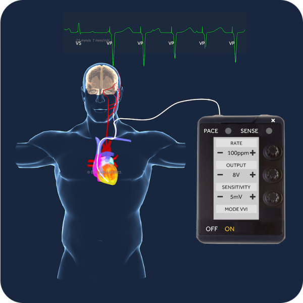 Trainee PACING monthly