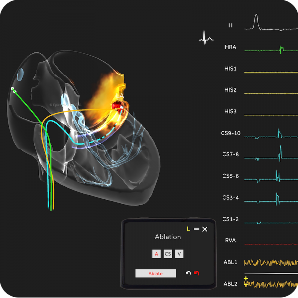 Epicardio Cardiac EP